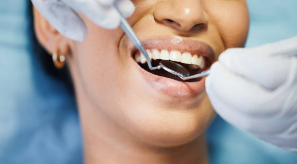 Best Broken or Cracked Tooth Emergency Dentist in Pomeroy, OH